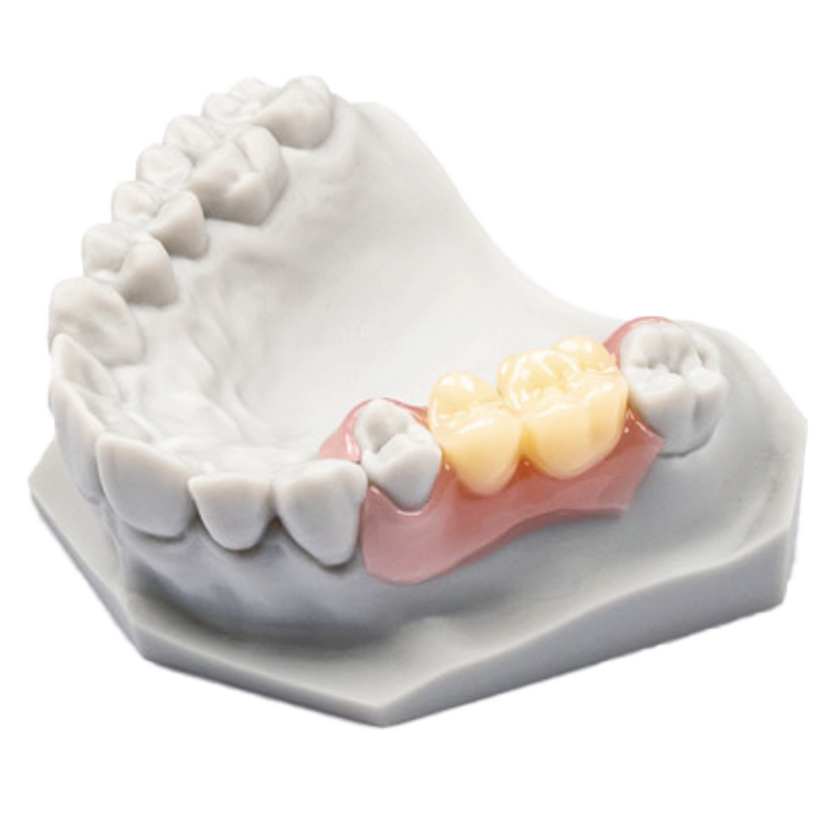 HeyGears Flexible Temporary Denture UV 1.0 – Gro3X