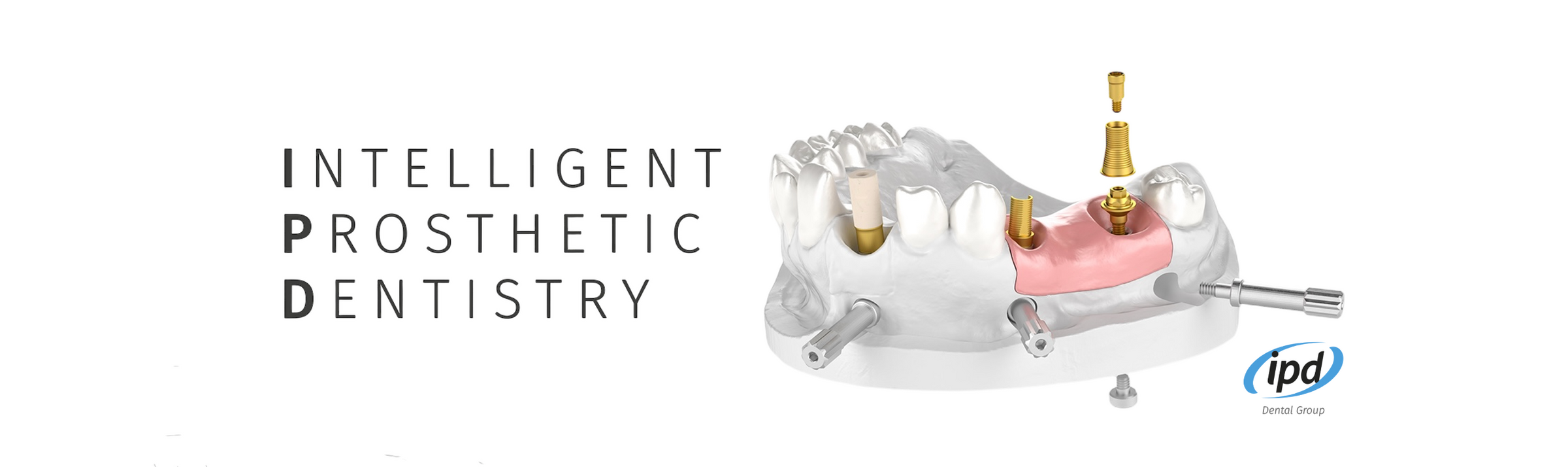 Abutment Solutions