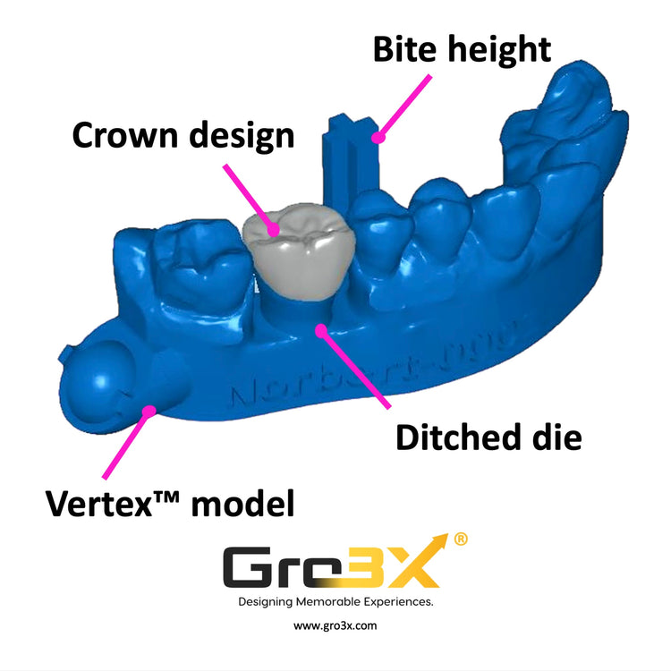 CrownAI dental crown design showing a Vertex model, crown restoration, bite height, and ditched die for digital dental lab workflows.