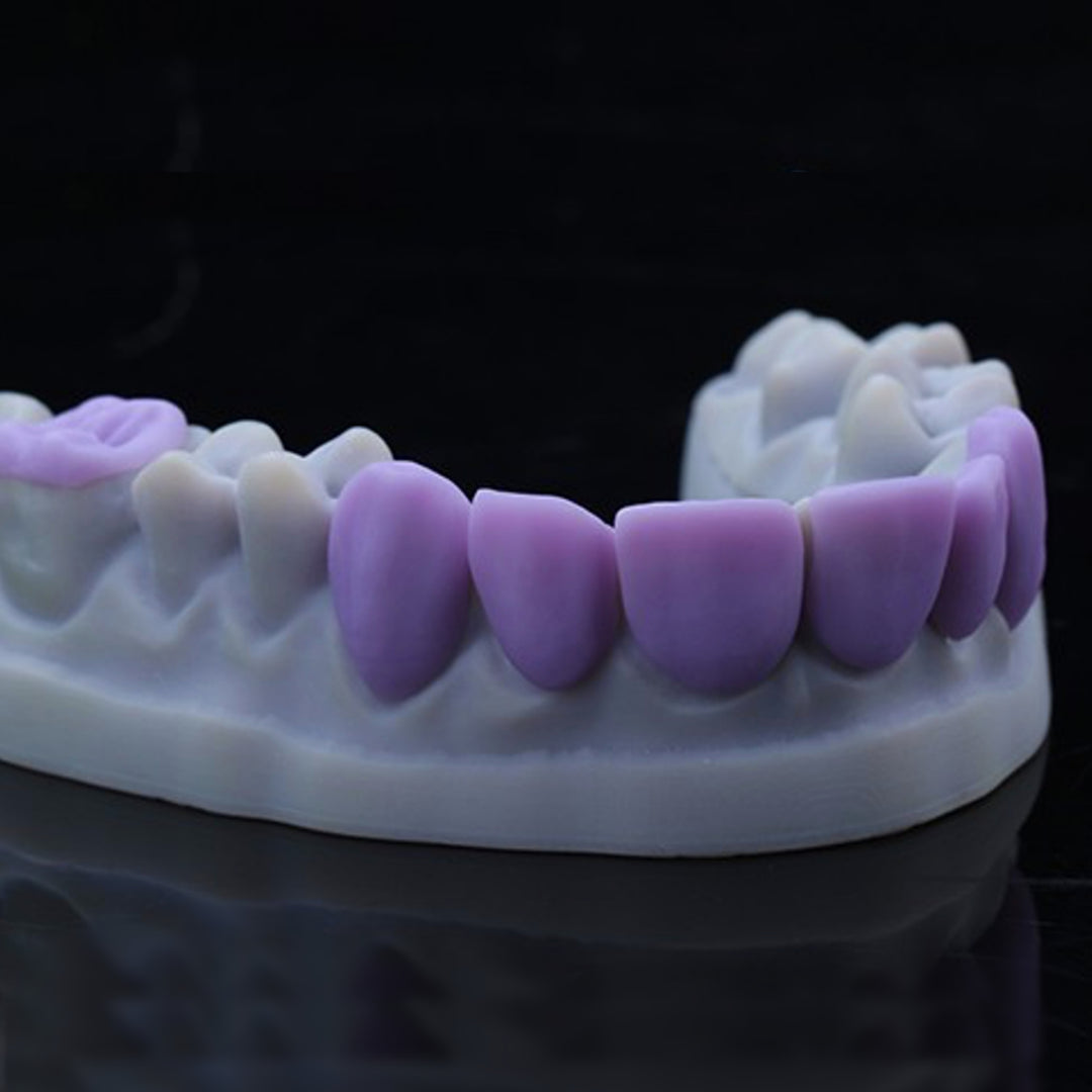 Purple pre-crystallized XTCERA Glass Ceramic anterior restorations on a dental model against a black background