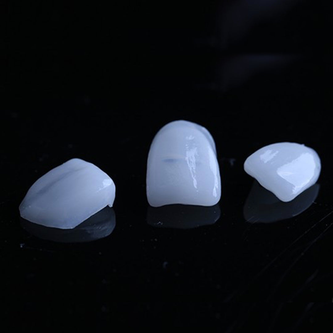 Three finished XTCERA Glass Ceramic veneer restorations on a black reflective surface