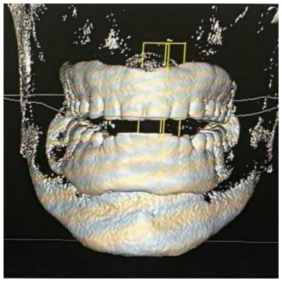 GR-16 Xray - Gro3X