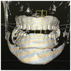 GR-16 Xray - Gro3X